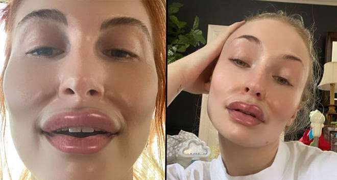 A continuación, le indicamos cómo utilizar el popular Pillow Face en Instagram.